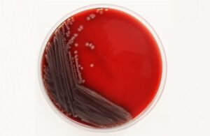 محیط کشت بلاد آگار چیست؟